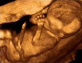 Embryo Embryo